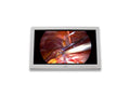 FORESEESON FS-P2603D 26IN Medical Monitor,High LED,2DVI,2SDI