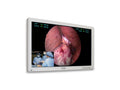 FORESEESON FS-L3202D 32INMEDICALMONITOR,HIGH LED,2DVI,2SDI