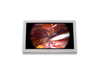 FORESEESON FS-P2603D 26IN Medical Monitor,High LED,2DVI,2SDI