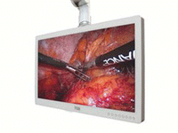 FORESEESON FS-P2604D HD Medical Monitor 26in